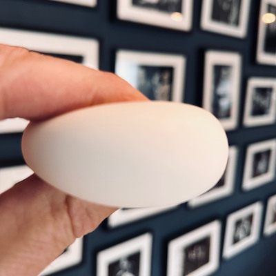 WONDER EGG